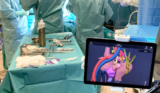 La tecnología 3D mejora los resultados de la cirugía en la enfermedad de Crohn, según un estudio