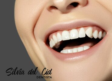 Clínica Dental Silvia del Cid en Torremolinos: innovando en odontología estética
